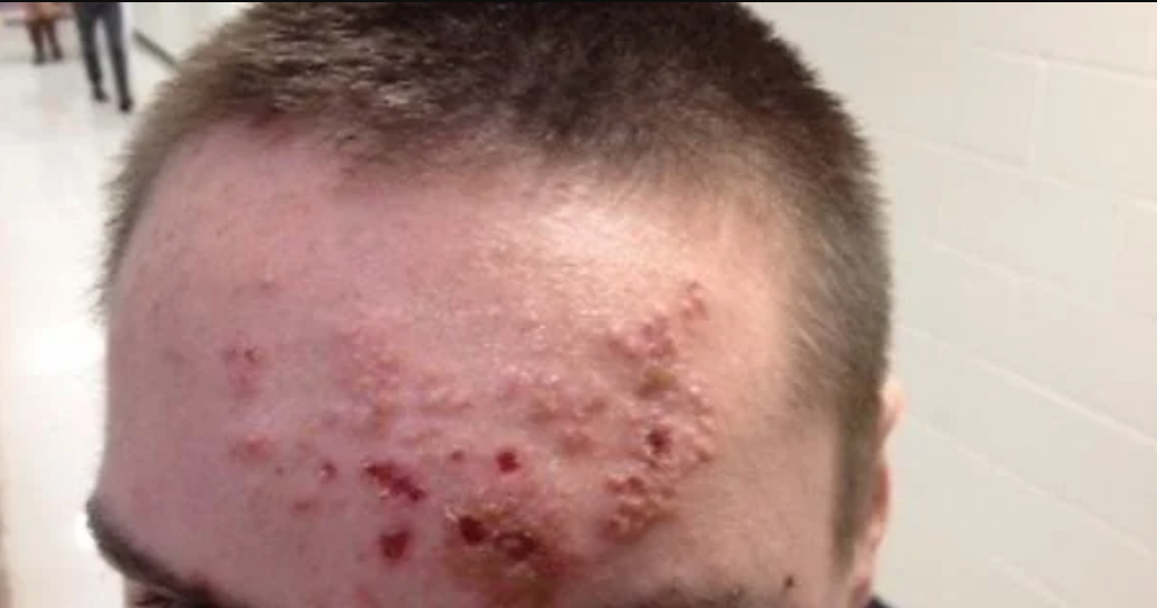 💸 The Real Cost of Mat Funk: Missed Practices, Medical Bills, Lost Seasons